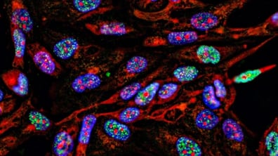 Tissue Biomarker Analysis